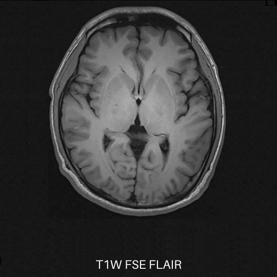 uMR OMEGA™ | 75-cm Ultra-Wide-Bore 3.0T