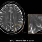 uMR 790 | High-Performance 3.0T MR