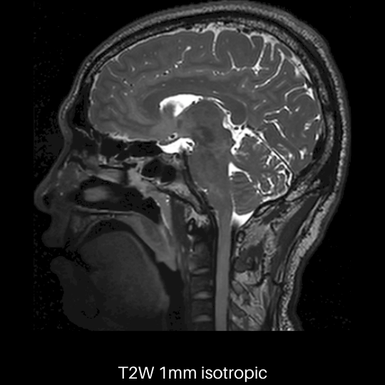 uMR 790 | High-Performance 3.0T MR