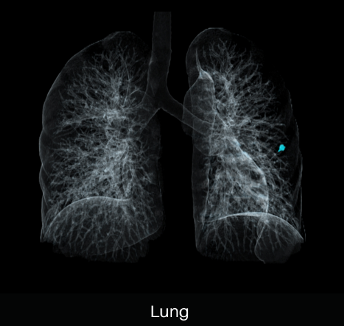 uCT 550 | 40 / 80 Slice