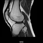 uMR 570 | 70cm Wide-Bore 1.5T MR