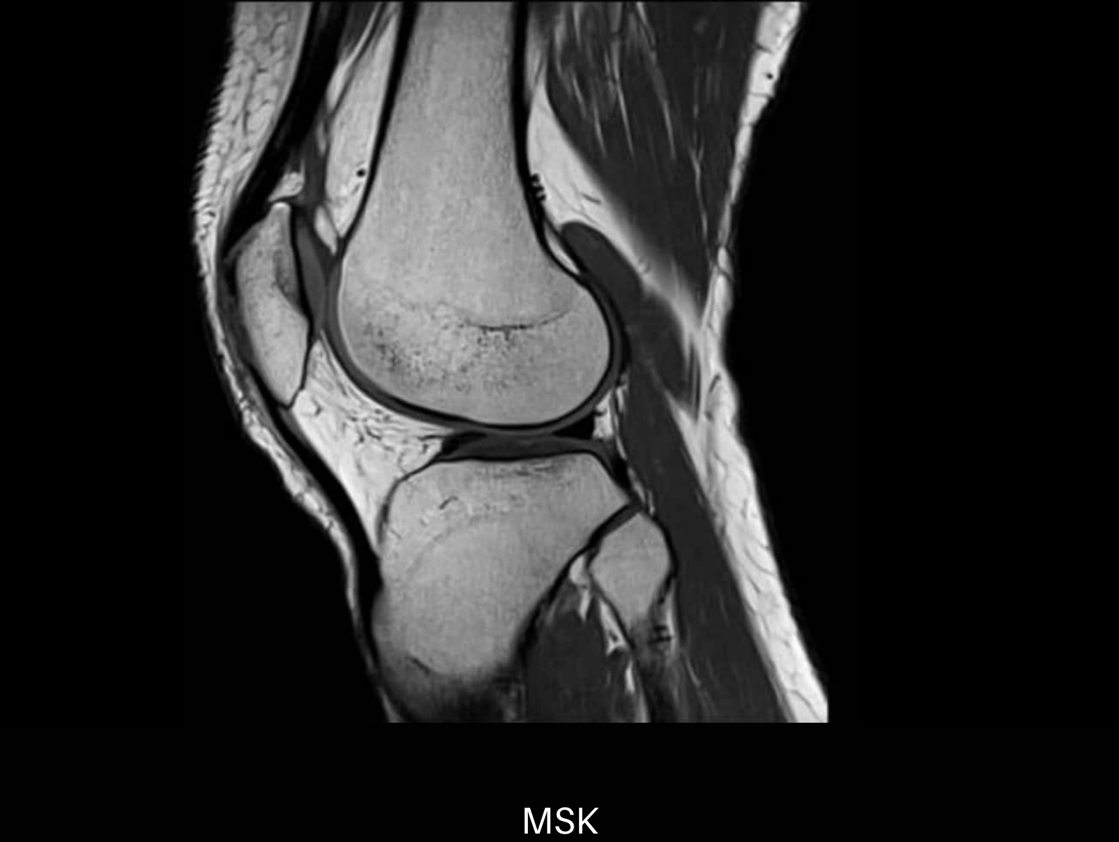 uMR 570 | 70cm Wide-Bore 1.5T MR
