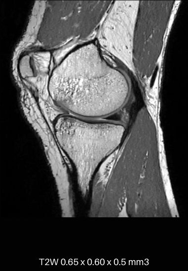 uMR 790 | High-Performance 3.0T MR