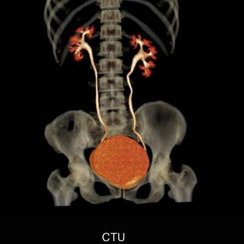 uCT 550 | 40 / 80 Slice