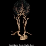 uCT 530 | 20 / 40 Slice