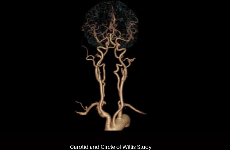 uCT 530 | 20 / 40 Slice