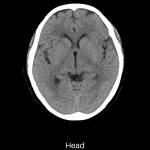 uCT 550 | 40 / 80 Slice