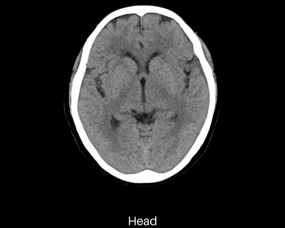 uCT 550 | 40 / 80 Slice