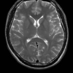 uMR 570 | 70cm Wide-Bore 1.5T MR