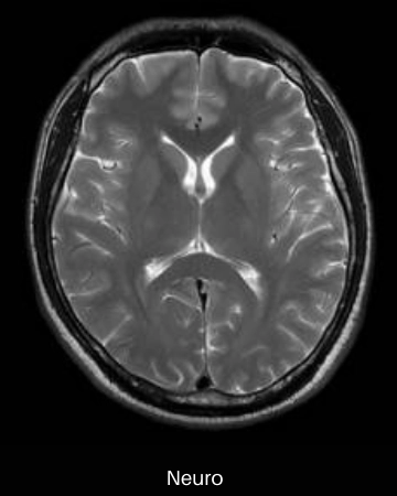 uMR 570 | 70cm Wide-Bore 1.5T MR