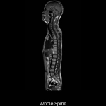 uMR 570 | 70cm Wide-Bore 1.5T MR