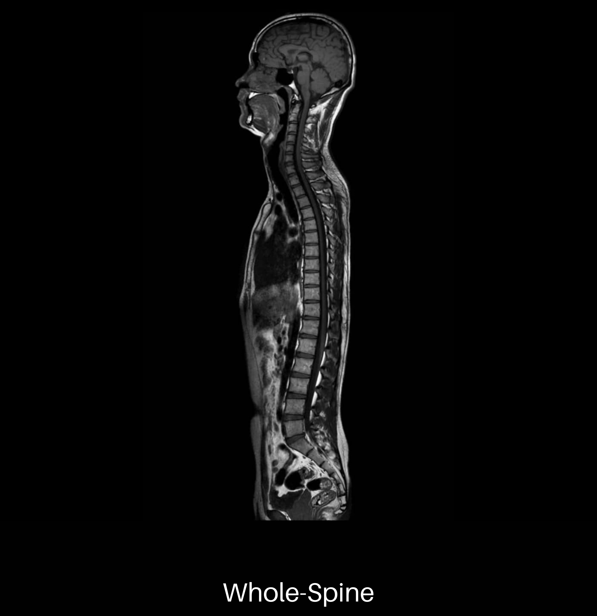 uMR 570 | 70cm Wide-Bore 1.5T MR