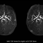 uMR 770 / 780 | 65cm Wide-Bore 3.0T MR