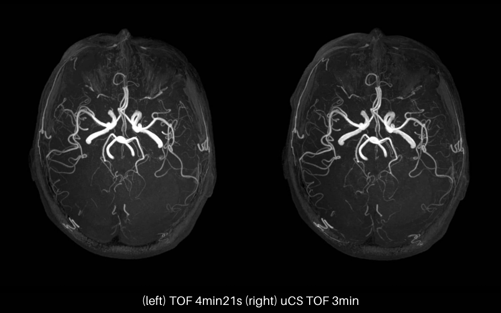 uMR 770 / 780 | 65cm Wide-Bore 3.0T MR