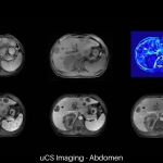 uMR 770 / 780 | 65cm Wide-Bore 3.0T MR