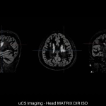 uMR 770 / 780 | 65cm Wide-Bore 3.0T MR