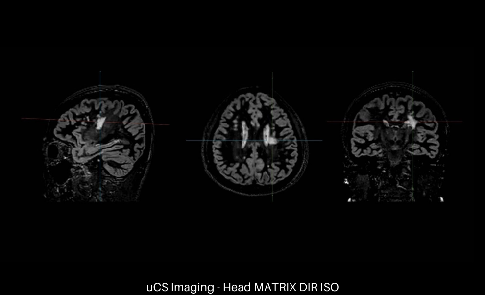 uMR 770 / 780 | 65cm Wide-Bore 3.0T MR
