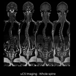 uMR 770 / 780 | 65cm Wide-Bore 3.0T MR