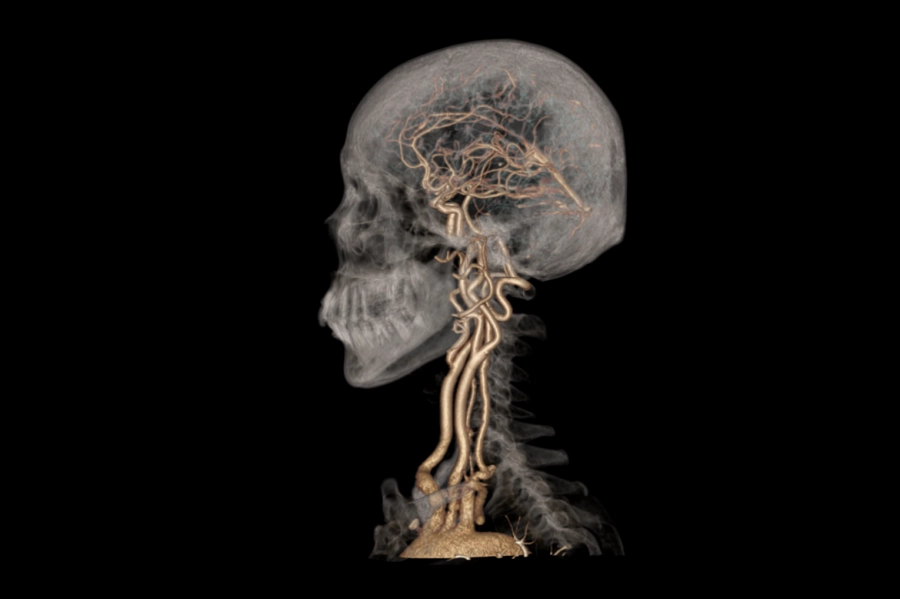 uCT 528 40 / 80 slice