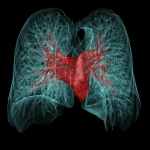 uCT 528 40 / 80 slice