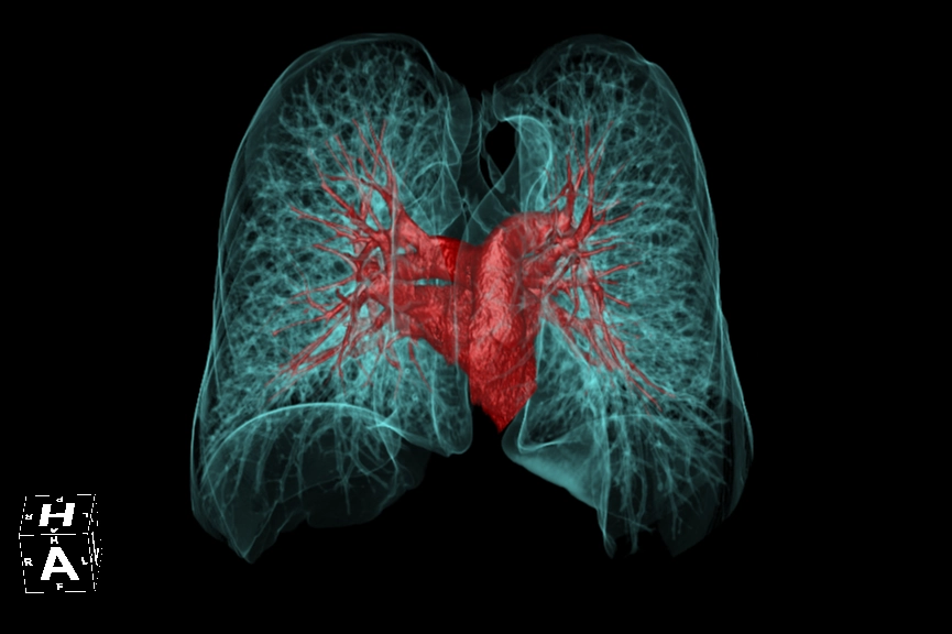 uCT 528 40 / 80 slice