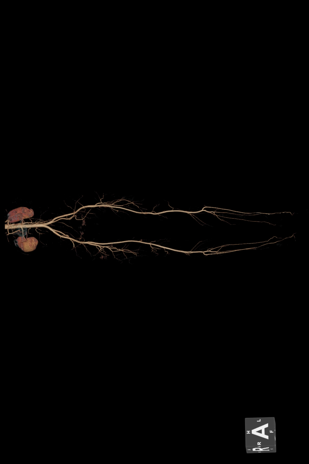 uCT 528 40 / 80 slice