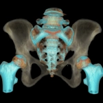 uCT 528 40 / 80 slice