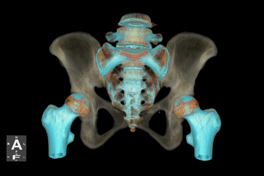uCT 528 40 / 80 slice