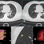 uCT 528 40 / 80 slice
