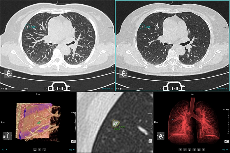 uCT 528 40 / 80 slice