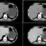 uCT 528 40 / 80 slice