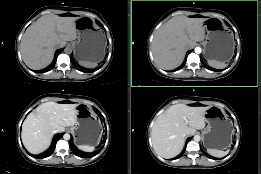 uCT 528 40 / 80 slice