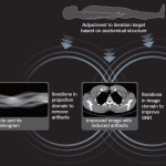 uCT 528 40 / 80 slice
