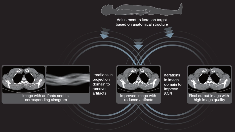 uCT 528 40 / 80 slice