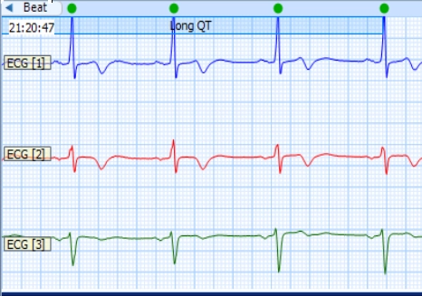 MEDILOG®AR & DARWIN 2, Holter Ρυθμού