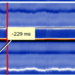 MEDILOG®AR & DARWIN 2, Holter Ρυθμού
