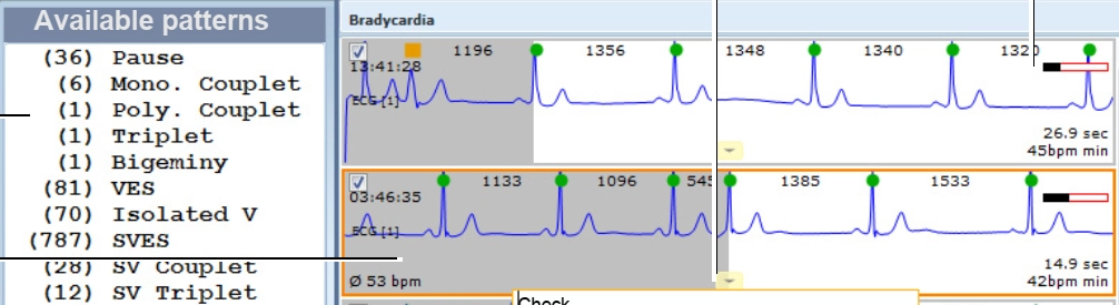 MEDILOG®AR & DARWIN 2, Holter Ρυθμού