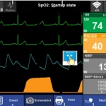 Διφασικός Απινιδωτής – Μόνιτορ DEFIGARD HD-7