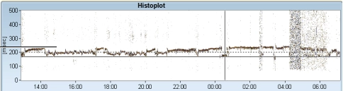 MEDILOG®AR & DARWIN 2, Holter Ρυθμού
