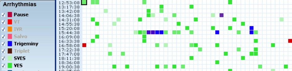 MEDILOG®AR & DARWIN 2, Holter Ρυθμού