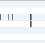 MEDILOG®AR & DARWIN 2, Holter Ρυθμού