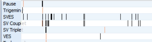 MEDILOG®AR & DARWIN 2, Holter Ρυθμού