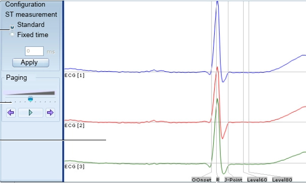 MEDILOG®AR & DARWIN 2, Holter Ρυθμού