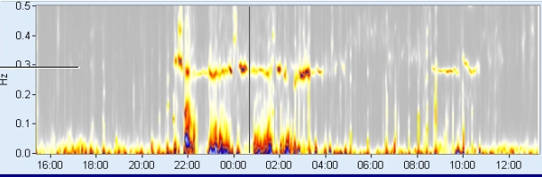 MEDILOG®AR & DARWIN 2, Holter Ρυθμού