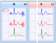 MEDILOG®AR & DARWIN 2, Holter Ρυθμού
