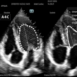 Φορητός Υπέρηχος Mindray ΜΕ7