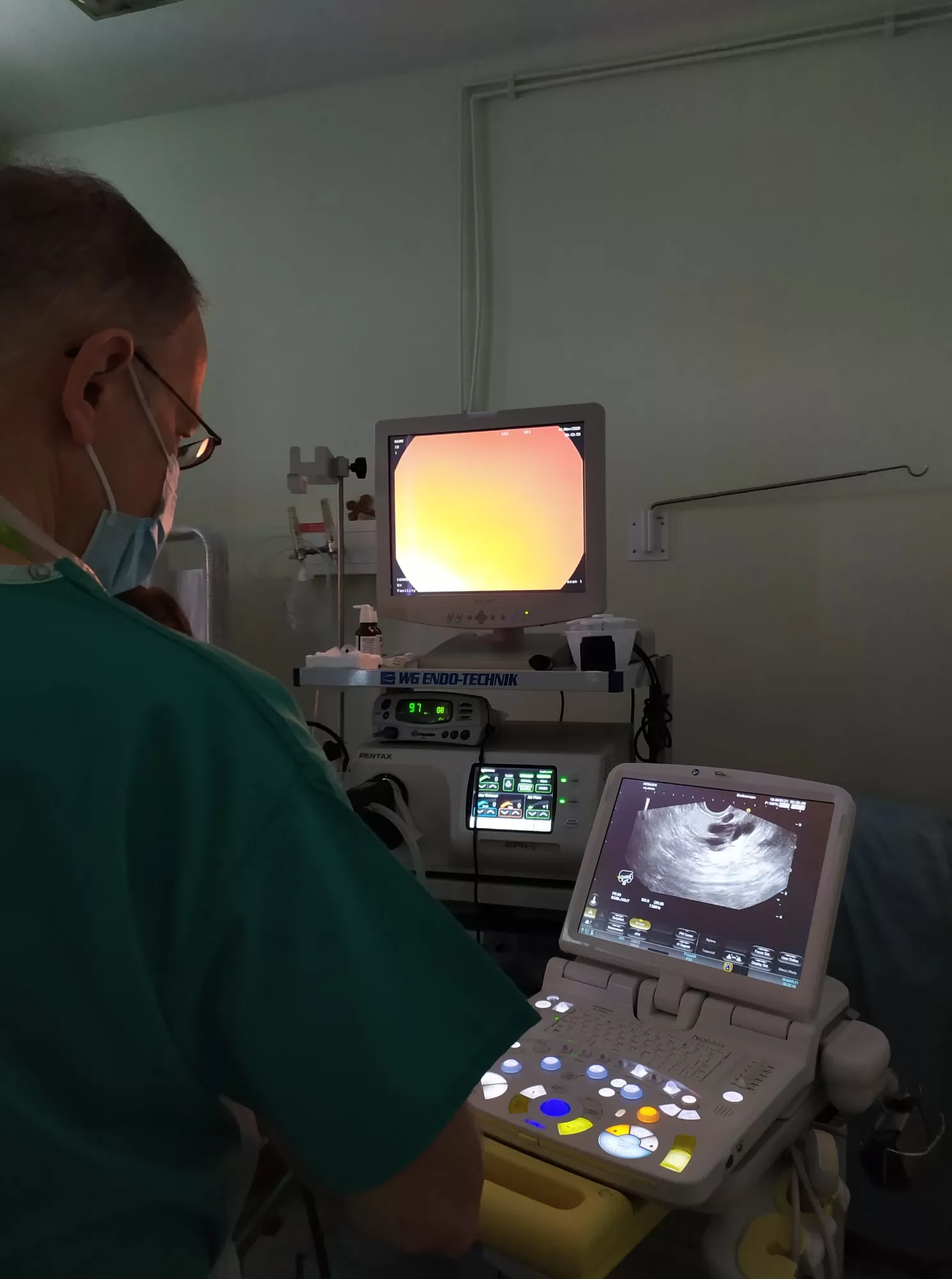 βιντεο-υπερηχογραστροσκοπιο βιντεο-υπερηχογραστροσκοπιο