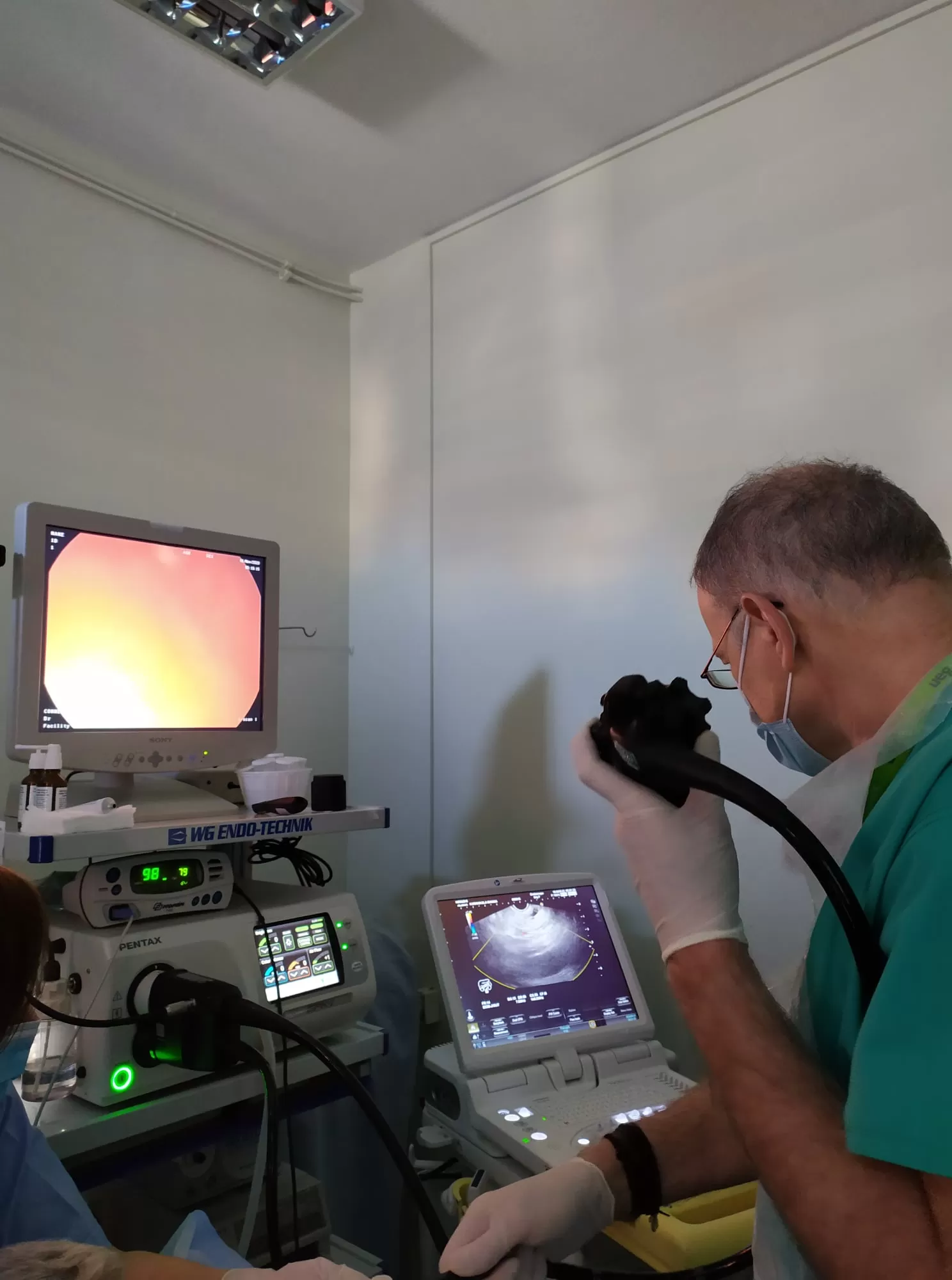 βιντεο-υπερηχογραστροσκοπιο pentax