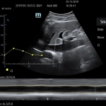 Φορητός Υπέρηχος Mindray ΜΕ7