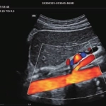 Φορητός Υπέρηχος Mindray ΜΕ7